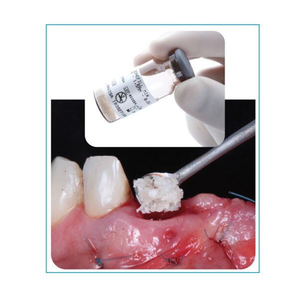 Denso Grueso cc 0,50= g0,50