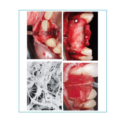 Surgitime Collagen 20 x 30 mm